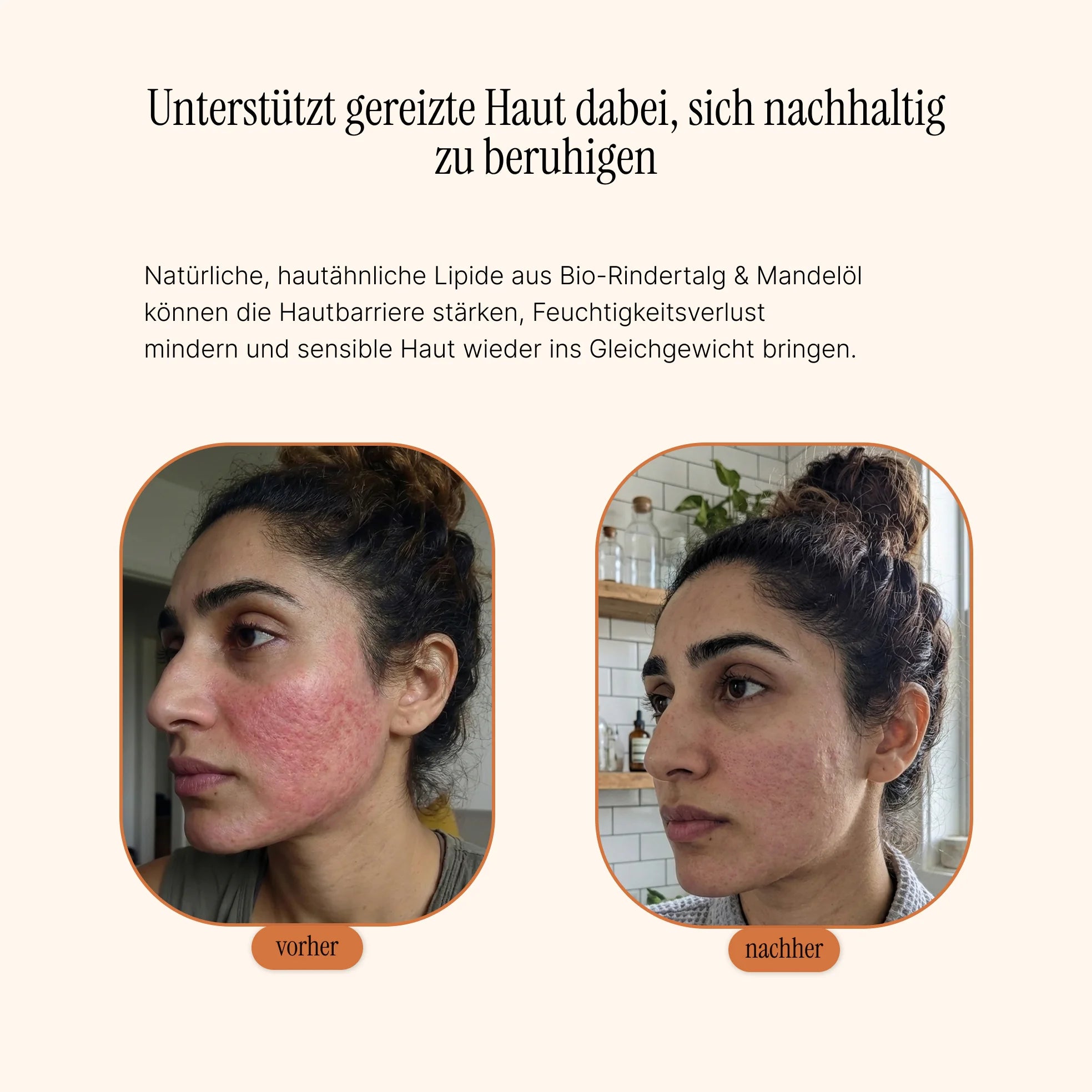 Essential Moisturizer – Barrier Restore Cream 60 Tage Skin Reset - AlmaSkin