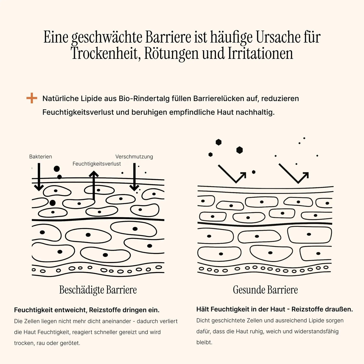 Essential Moisturizer - AlmaSkin - Die Hautbarriere ist überfordert