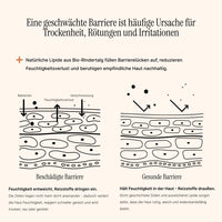 Essential Moisturizer - AlmaSkin - Die Hautbarriere ist überfordert