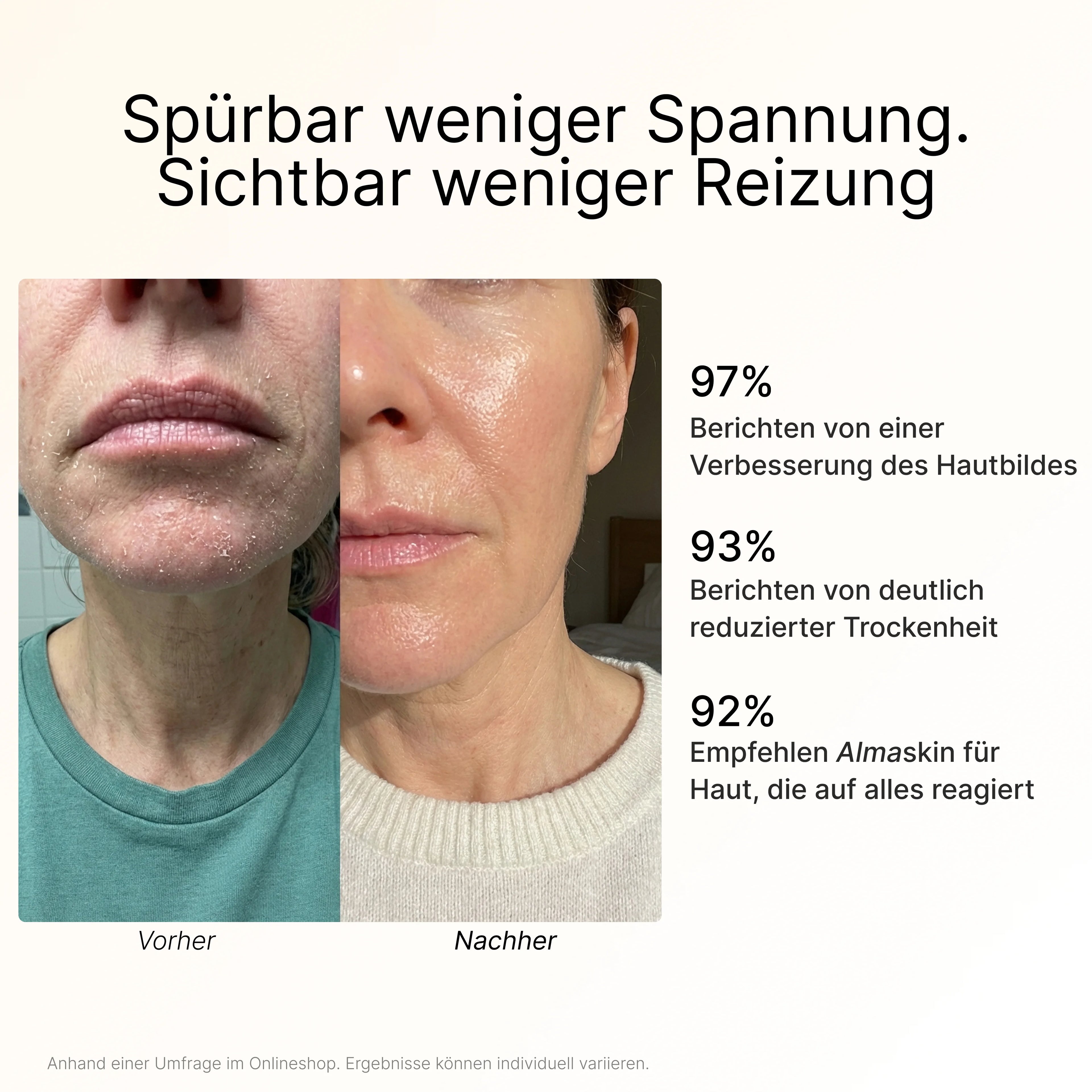 Barrier Restore Moisturizer mit Bio-Rindertalg